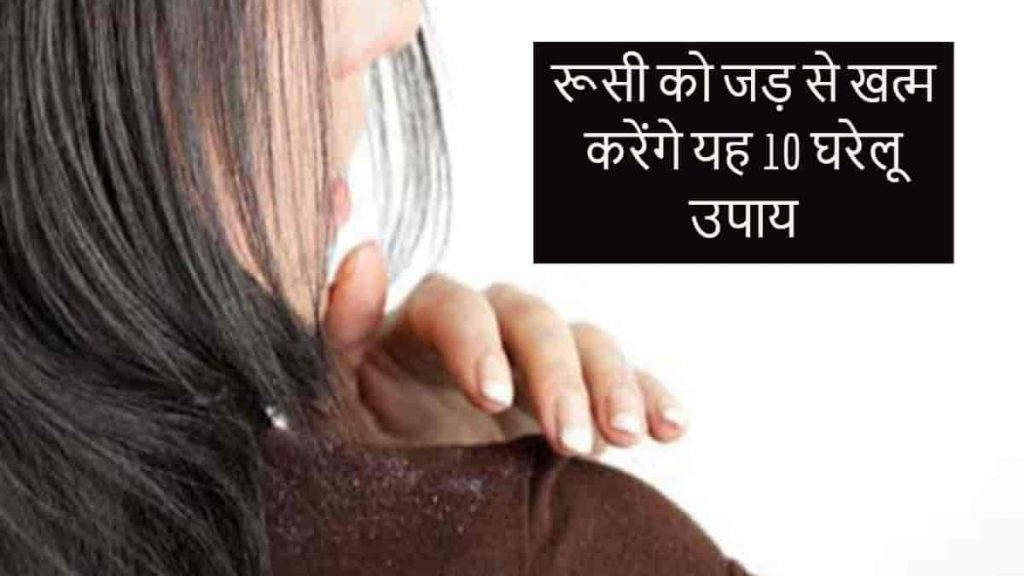 dandruff treatment in hindi