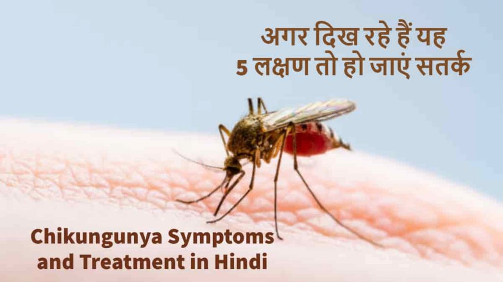 Chikungunya Symptoms and Treatment in Hindi